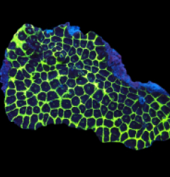 Favites sp. (Special Colored) (L) pb 290